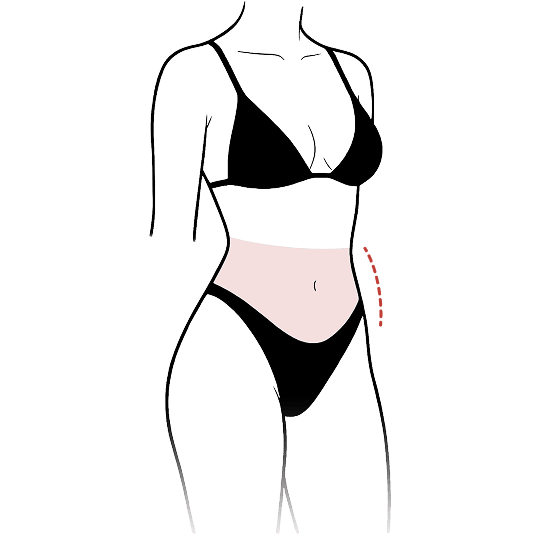 Flatter